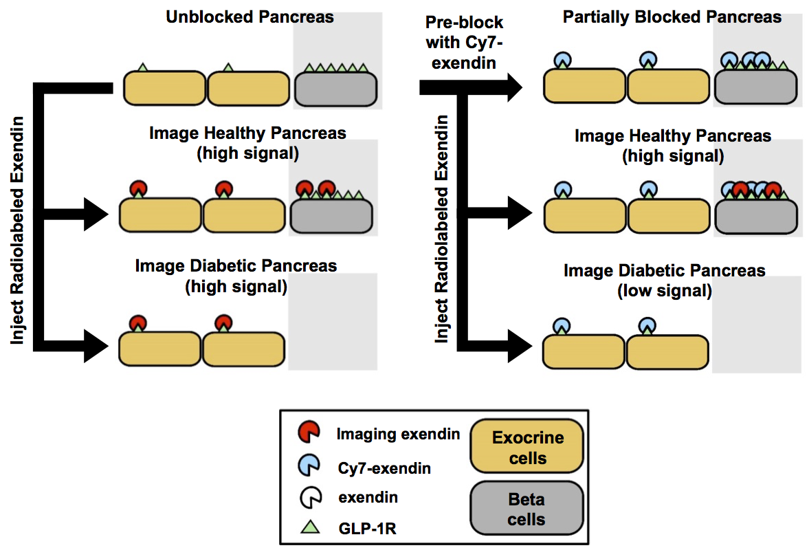 Image showcasing Blocking Glucagon Like Peptide-1 Receptors in the Exocrine Pancreas ...