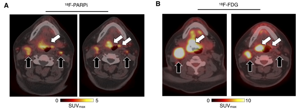 standard of care 18F-FDG and 18F-PARPi